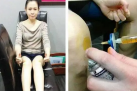 刘若英应用干细胞注射告别了膝盖疼痛之苦