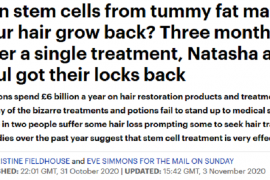 脱发的最新治疗方法：干细胞疗法
