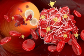 纳豆激酶经典抗血栓产品，纳豆酵素清理血管永不过时！
