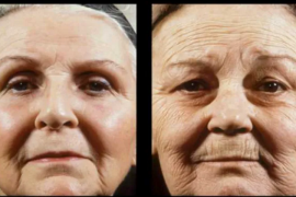 皮肤老化的现象有哪些？胶原蛋白在皮肤老化过程中的作用