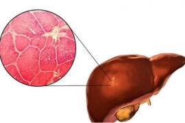 枸杞子多糖对肝脏细胞激活及肝损伤修复作用的研究