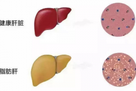 干细胞技术在肝脏病修复中的作用，肝细胞与肝脏