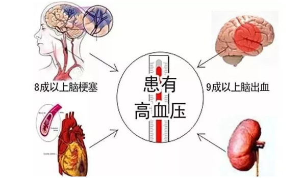 干细胞能治疗高血压吗.png