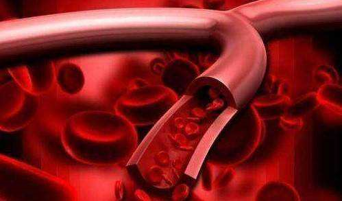 地龙蛋白肽清除血液垃圾有效预防糖尿病并发症